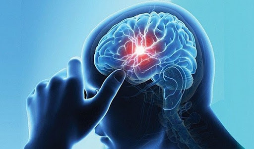 Chi tiết: Chứng đột quỵ khiến danh hài Chí Tài qua đời nguy hiểm cỡ nào? Cách phòng tránh và xử trí thần tốc tính bằng giây để thoát khỏi cửa tử - Ảnh 1.